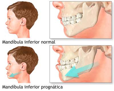 cirugia buco maxilo facial Cirugia buco maxilo facial